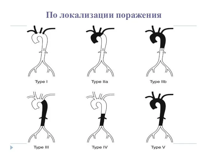 По локализации поражения