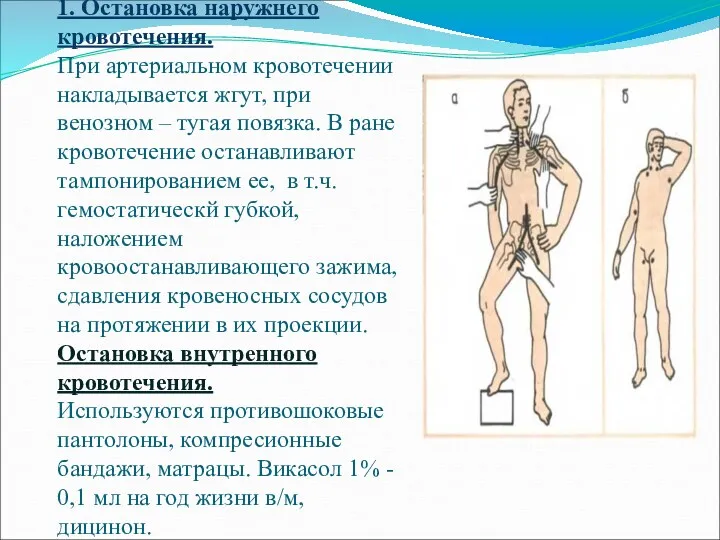 1. Остановка наружнего кровотечения. При артериальном кровотечении накладывается жгут, при