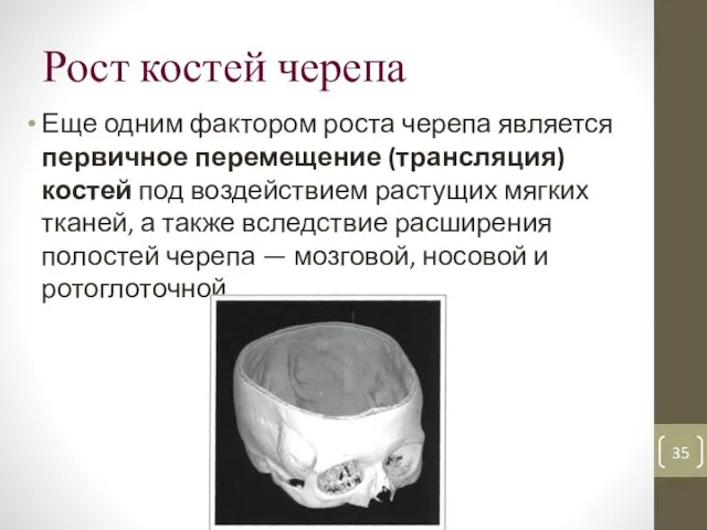 Рост костей черепа Еще одним фактором роста черепа является первичное перемещение (трансляция) костей