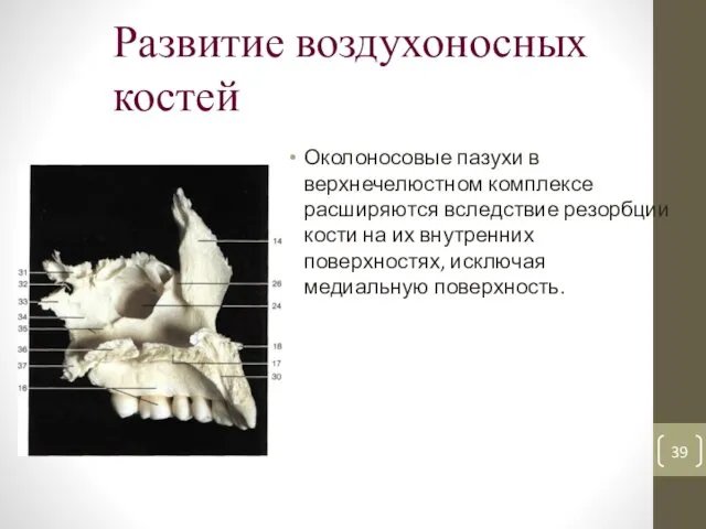 Развитие воздухоносных костей Околоносовые пазухи в верхнечелюстном комплексе расширяются вследствие резорбции кости на