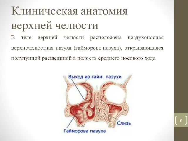 Клиническая анатомия верхней челюсти В теле верхней челюсти расположена воздухоносная верхнечелюстная пазуха (гайморова