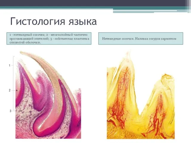 Гистология языка 1 - нитевидный сосочек; 2 - многослойный частично