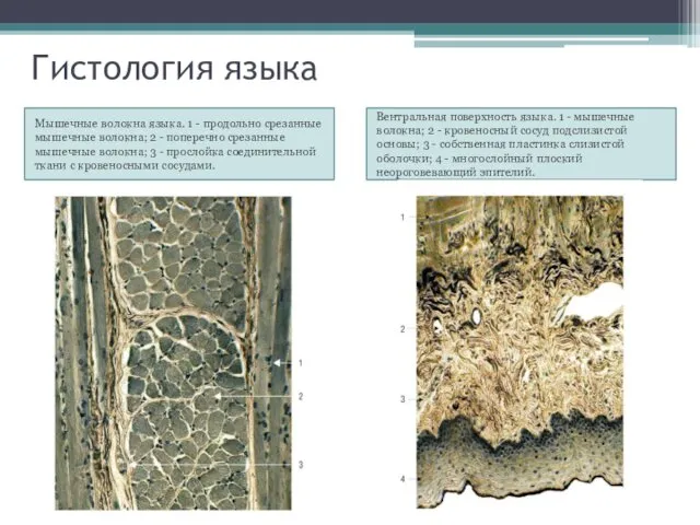 Гистология языка Мышечные волокна языка. 1 - продольно срезанные мышечные