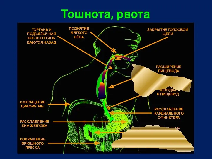 СОКРАЩЕНИЕ СФИНКТЕРА ПРИВРАТНИКА РАССЛАБЛЕНИЕ КАРДИАЛЬНОГО СФИНКТЕРА РАССЛАБЛЕНИЕ ДНА ЖЕЛУДКА ПОСТУПЛЕНИЕ СОДЕРЖИМОГО ЖЕЛУДКА В