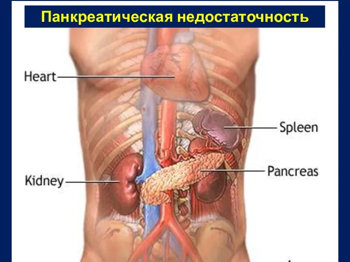 Панкреатическая недостаточность