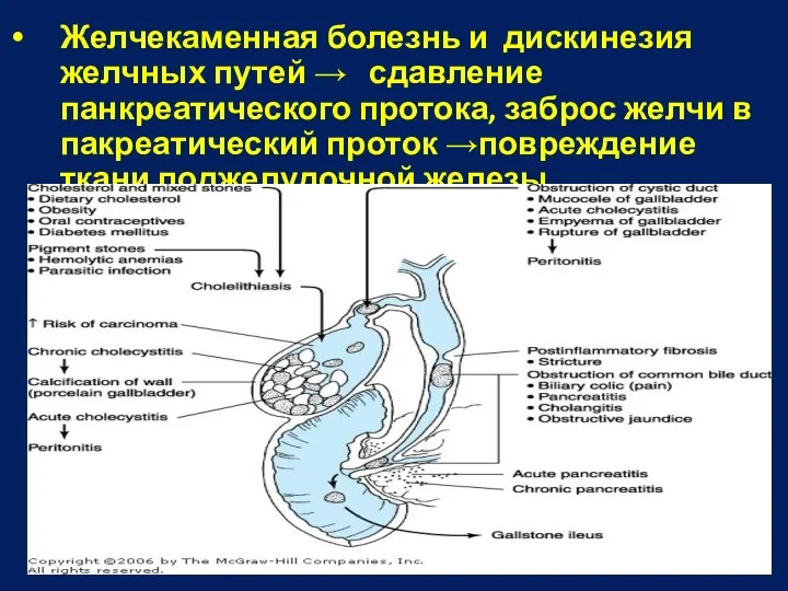 Желчекаменная болезнь и дискинезия желчных путей → сдавление панкреатического протока, заброс желчи в