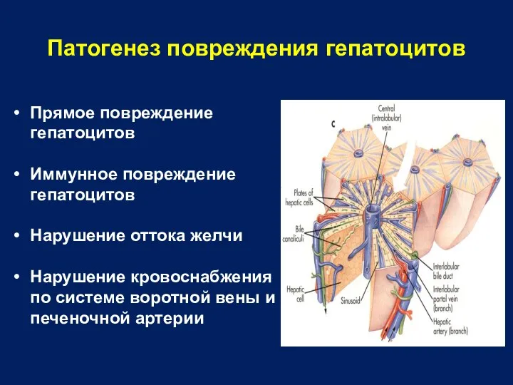 Патогенез повреждения гепатоцитов Прямое повреждение гепатоцитов Иммунное повреждение гепатоцитов Нарушение оттока желчи Нарушение