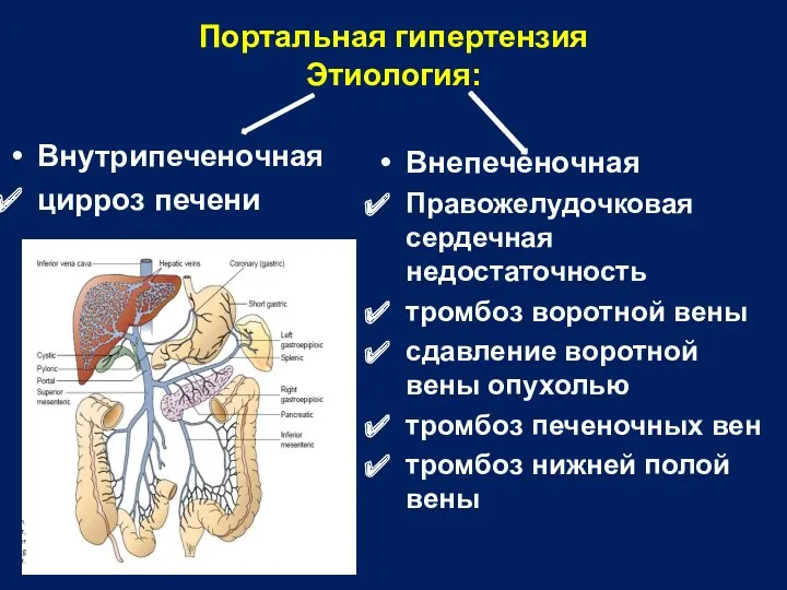 Портальная гипертензия Этиология: Внутрипеченочная цирроз печени Внепеченочная Правожелудочковая сердечная недостаточность тромбоз воротной вены