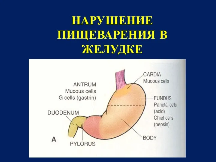 НАРУШЕНИЕ ПИЩЕВАРЕНИЯ В ЖЕЛУДКЕ