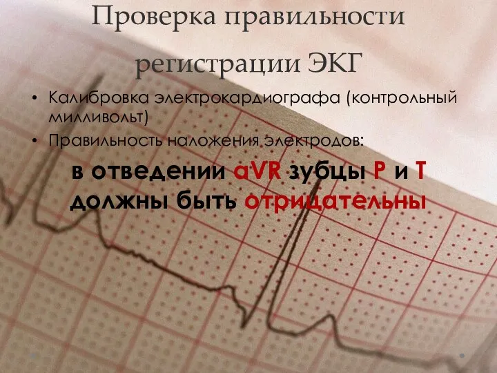 Проверка правильности регистрации ЭКГ Калибровка электрокардиографа (контрольный милливольт) Правильность наложения