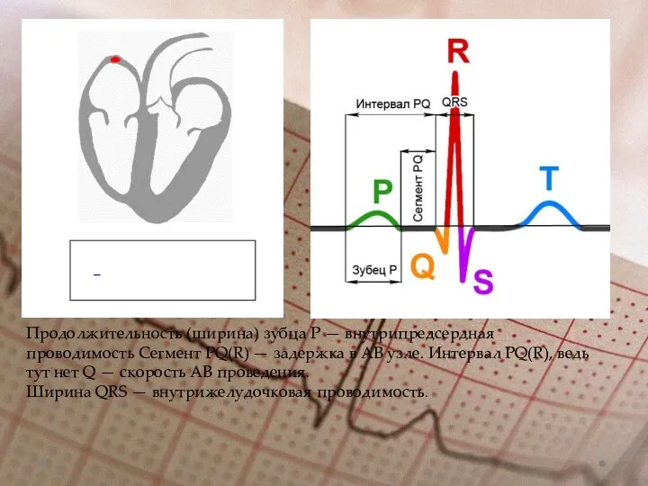 Продолжительность (ширина) зубца Р — внутрипредсердная проводимость Сегмент PQ(R) —