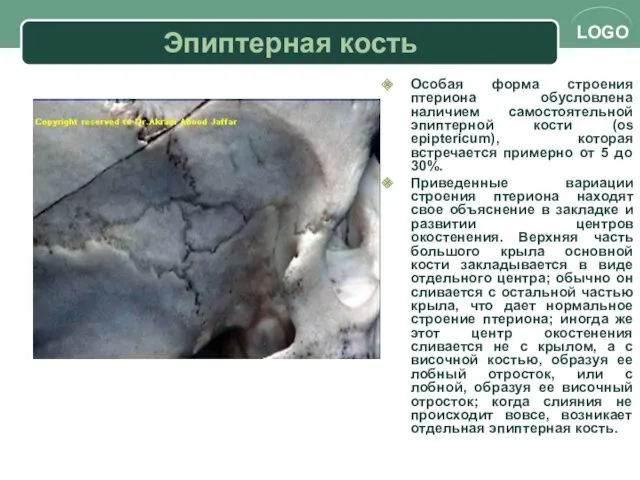 Эпиптерная кость Особая форма строения птериона обусловлена наличием самостоятельной эпиптерной