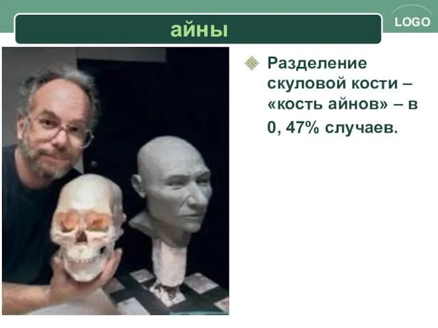 айны Разделение скуловой кости – «кость айнов» – в 0, 47% случаев.