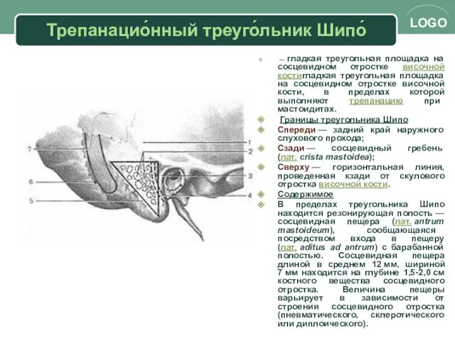 Трепанацио́нный треуго́льник Шипо́ — гладкая треугольная площадка на сосцевидном отростке