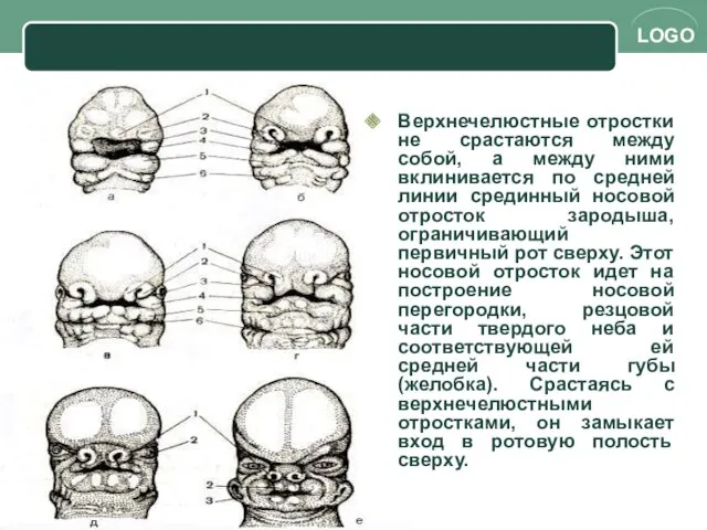 Верхнечелюстные отростки не срастаются между собой, а между ними вклинивается