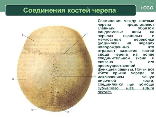 Соединения костей черепа Соединения между костями черепа представляют главным образом