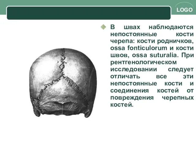 В швах наблюдаются непостоянные кости черепа: кости родничков, ossa fonticulorum