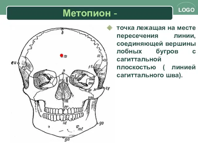 Метопион - точка лежащая на месте пересечения линии, соединяющей вершины