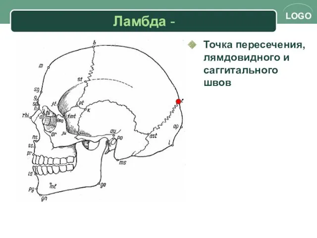 Ламбда - Точка пересечения, лямдовидного и саггитального швов