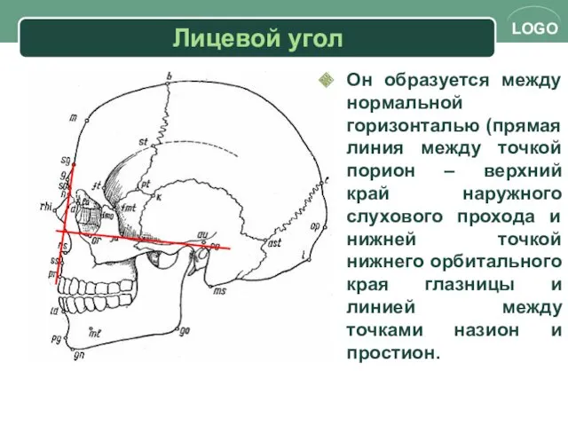 Лицевой угол Он образуется между нормальной горизонталью (прямая линия между