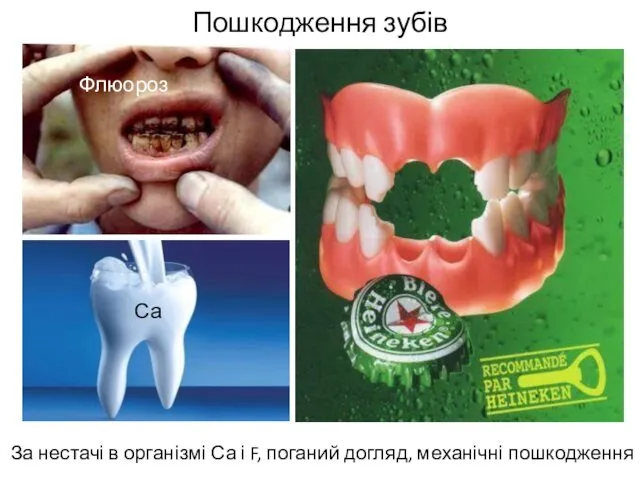 Пошкодження зубів За нестачі в організмі Са і F, поганий догляд, механічні пошкодження Флюороз Са