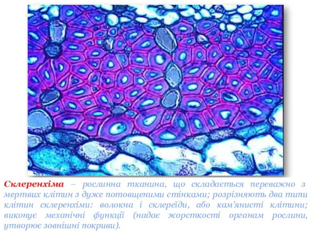 Склеренхіма – рослинна тканина, що складається переважно з мертвих клітин з дуже потовщеними