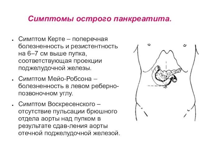 Симптомы острого панкреатита. Симптом Керте – поперечная болезненность и резистентность