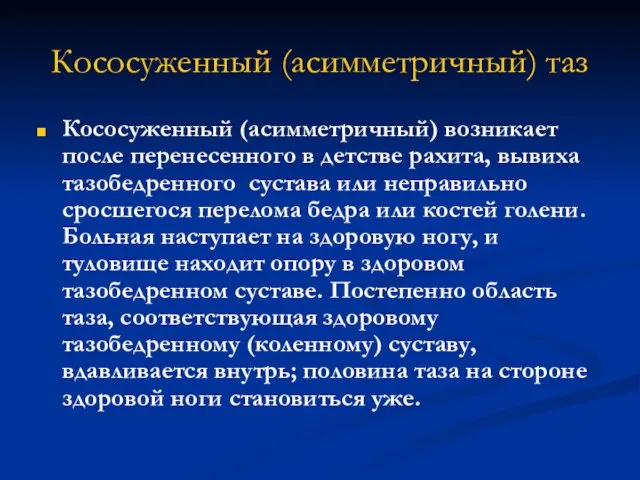 Кососуженный (асимметричный) таз Кососуженный (асимметричный) возникает после перенесенного в детстве