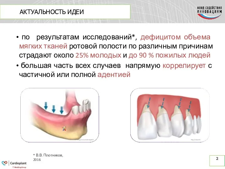 АКТУАЛЬНОСТЬ ИДЕИ 2 по результатам исследований*, дефицитом объема мягких тканей ротовой полости по