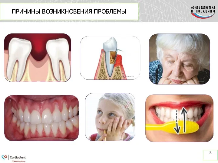ПРИЧИНЫ ВОЗНИКНОВЕНИЯ ПРОБЛЕМЫ 3 http://mydentist.ru https://simpladent.com http://health-lifes https://davinci-clinic http://health https://www.adme
