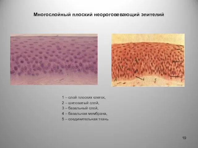 Многослойный плоский неороговевающий эпителий 1 – слой плоских клеток, 2