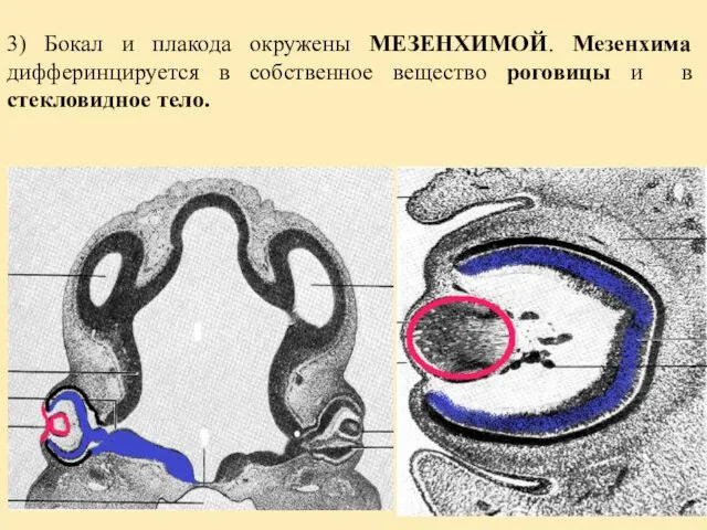 3) Бокал и плакода окружены МЕЗЕНХИМОЙ. Мезенхима дифферинцируется в собственное вещество роговицы и в стекловидное тело.