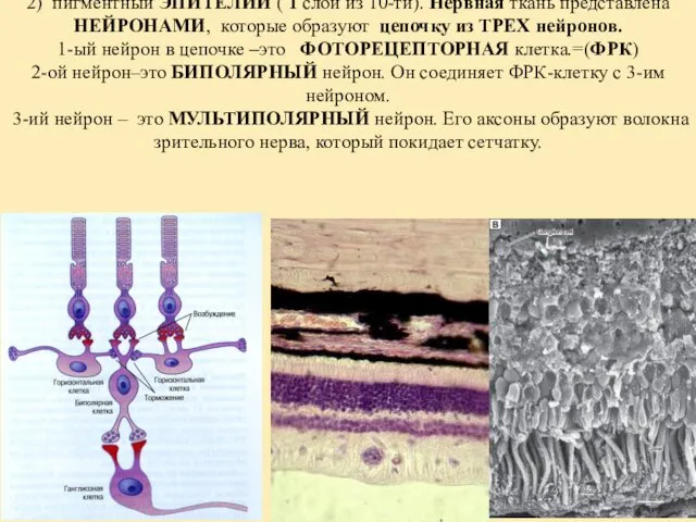 СЕТЧАТКА (retina). Состоит из: 2-ух тканей: 1) НЕРВНАЯ ткань (9
