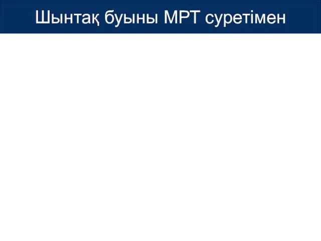 Шынтақ буыны МРТ суретімен