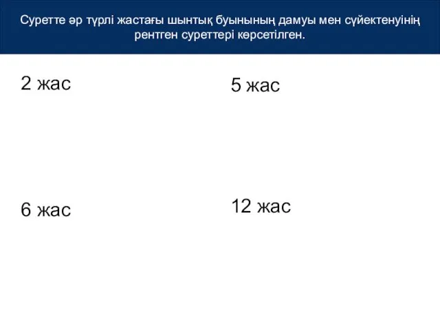 Суретте әр түрлі жастағы шынтық буынының дамуы мен сүйектенуінің рентген