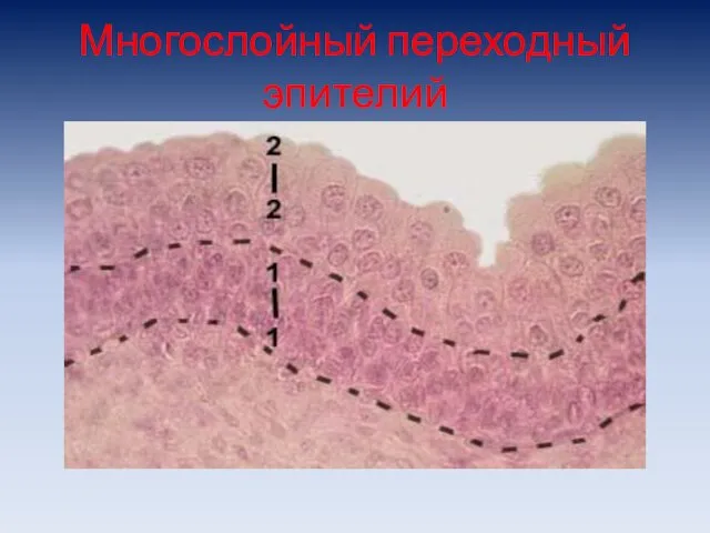 Многослойный переходный эпителий