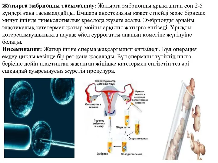 Жатырға эмбрионды тасымалдау: Жатырға эмбрионды ұрықтанған соң 2-5 күндері ғана