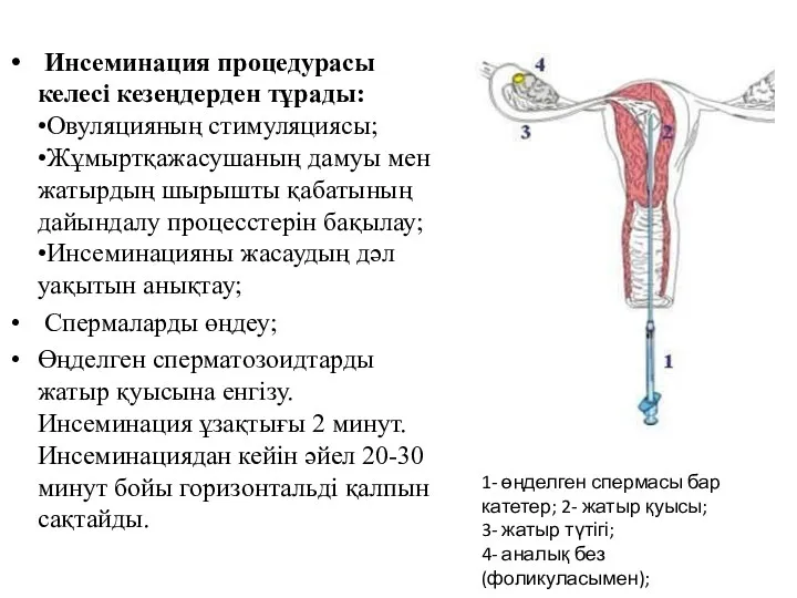 Инсеминация процедурасы келесі кезеңдерден тұрады: •Овуляцияның стимуляциясы; •Жұмыртқажасушаның дамуы мен