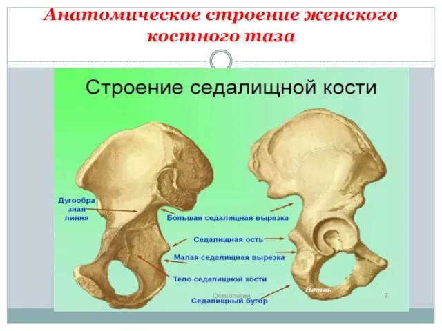 Анатомическое строение женского костного таза Седалищная кость (os ischii)