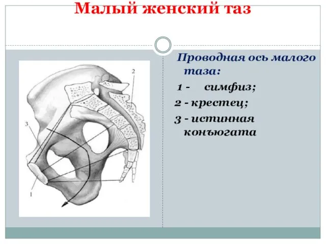 Малый женский таз Проводная ось малого таза: 1 - симфиз;