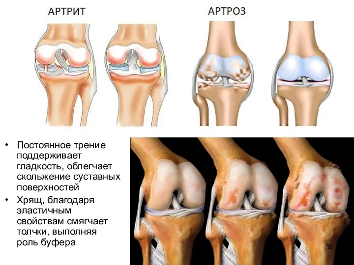 Постоянное трение поддерживает гладкость, облегчает скольжение суставных поверхностей Хрящ, благодаря