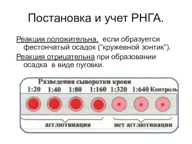 Постановка и учет РНГА. Реакция положительна, если образуется фестончатый осадок