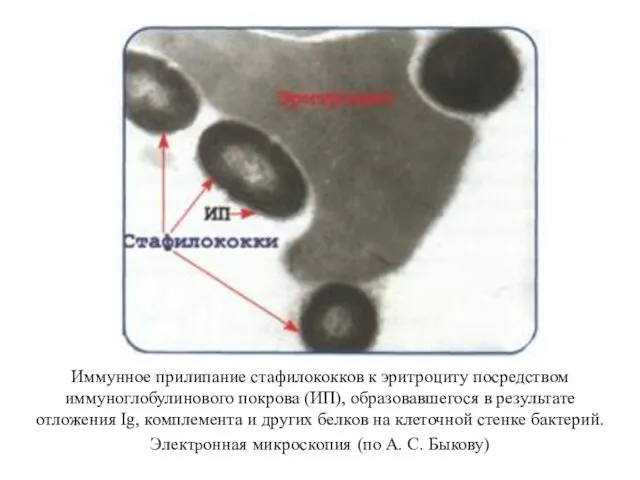 Иммунное прилипание стафилококков к эритроциту посредством иммуноглобулинового покрова (ИП), образовавшегося