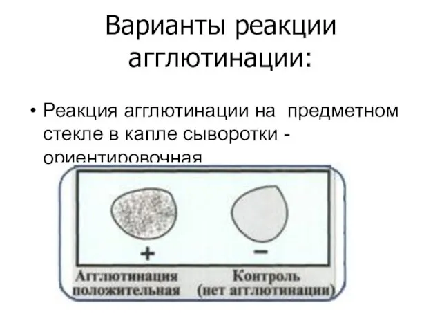 Варианты реакции агглютинации: Реакция агглютинации на предметном стекле в капле сыворотки - ориентировочная