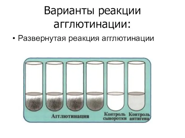 Варианты реакции агглютинации: Развернутая реакция агглютинации