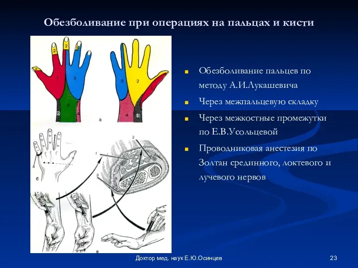 Доктор мед. наук Е.Ю.Осинцев Обезболивание при операциях на пальцах и