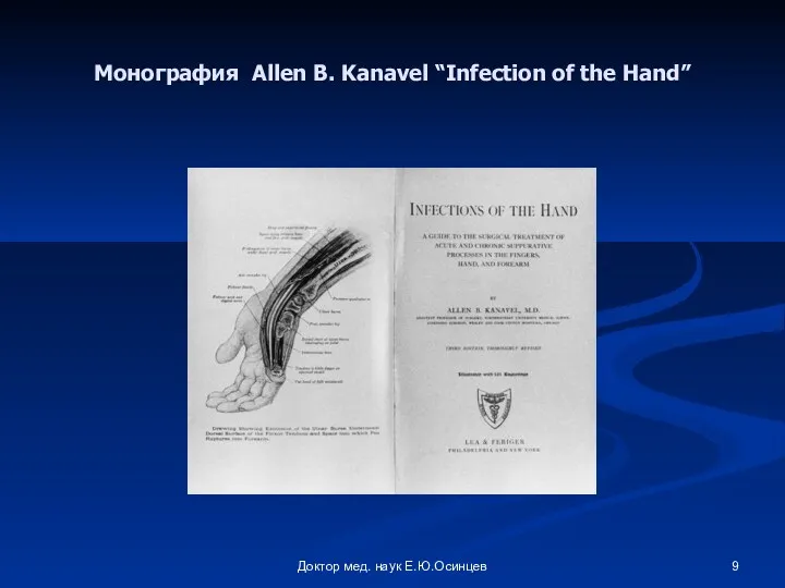 Доктор мед. наук Е.Ю.Осинцев Монография Allen B. Kanavel “Infection оf the Hand”