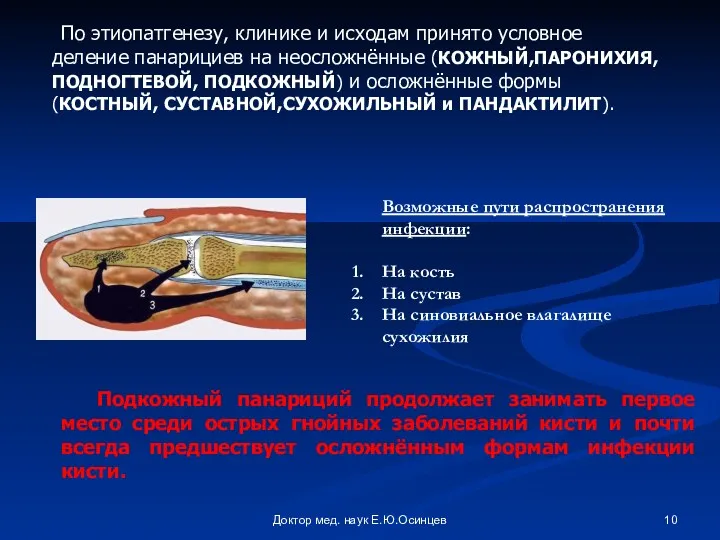 Доктор мед. наук Е.Ю.Осинцев Подкожный панариций продолжает занимать первое место