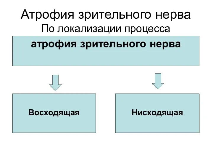 Атрофия зрительного нерва По локализации процесса Восходящая Нисходящая