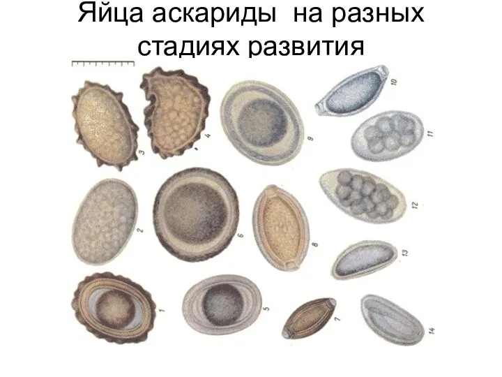 Яйца аскариды на разных стадиях развития